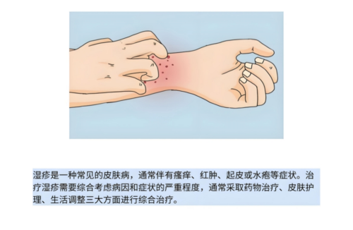 湿疹_副本_副本.png